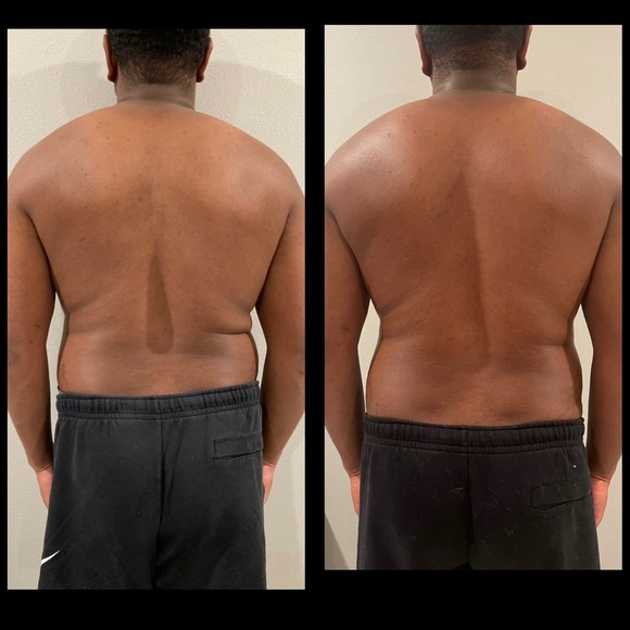 Cryosculpting Machine - Picture 10 of 12